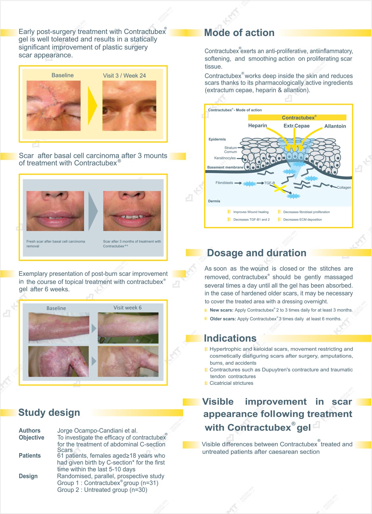 cum de a determina dimensiunea coloanelor în varicoza bandage wraps în varicoza